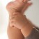 Hyperemesis